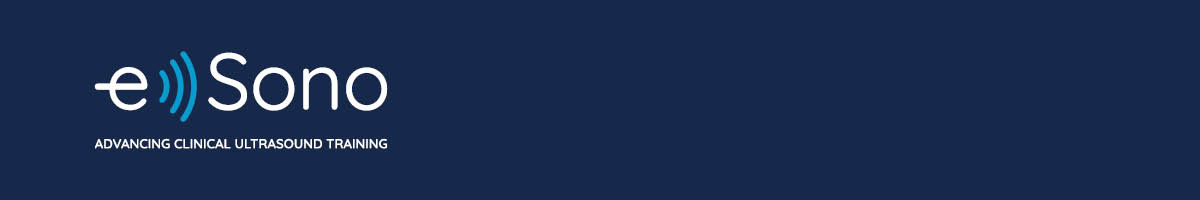 23-08_Banner_eSono_HubspotLandingPageHeader_1200x200 23-08_Banner_eSono_HubspotLandingPageHeader_1200x200